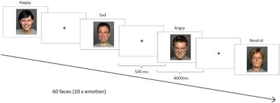 Oral Contraceptives Modulate the Relationship Between Resting Brain Activity, Amygdala Connectivity and Emotion Recognition – A Resting State fMRI Study